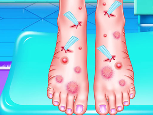 Read more about the article Emma Foot Treatment