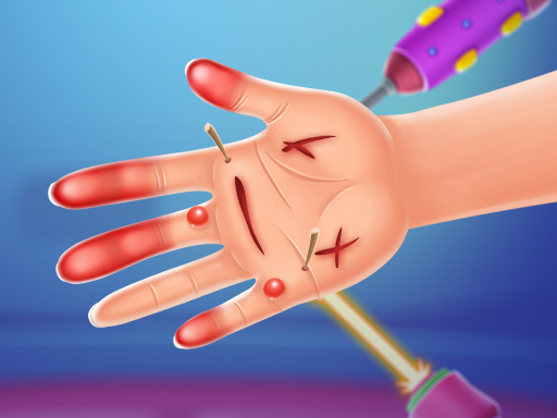 Read more about the article Hand Doctor